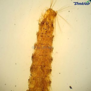 Tiêu bản ấu trùng muỗi Anopheles - DMK Lab