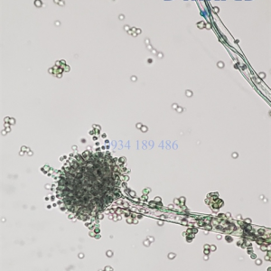 Tiêu Bản Nấm Aspergillus Flavus